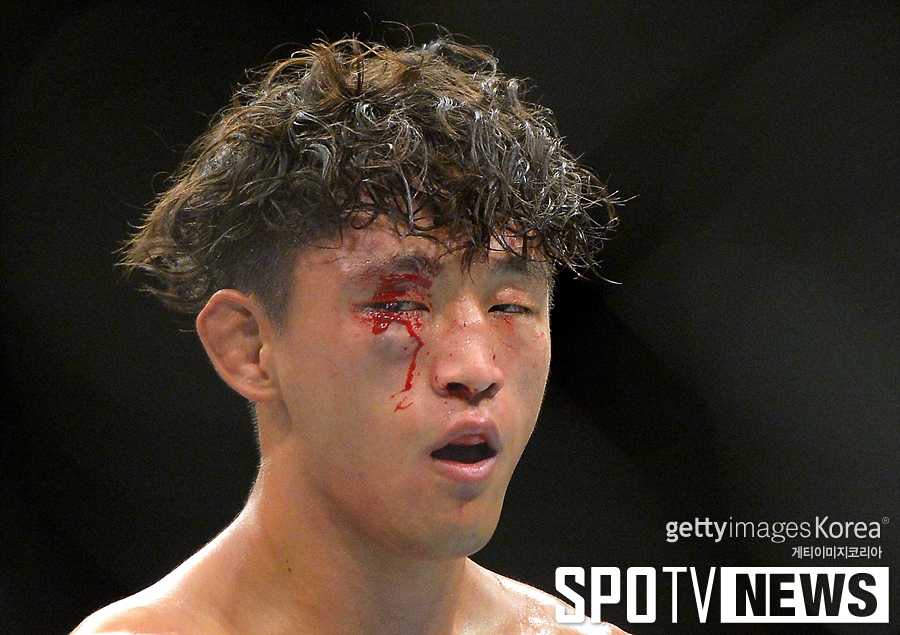 [UFC 199] 김동현, 1라운드 마치고 안와 골절 온 듯