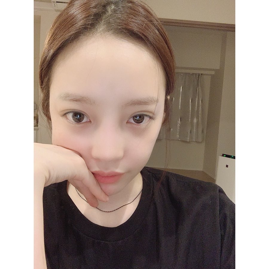 구하라,'쌍수' 의혹→SNS 설전→안검하수 고백→근황공개…또렷해진 눈매[종합]