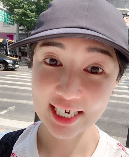 앞니 라미네이트 떨어진 사유리…"바람 잘 통해"[SNS컷]
