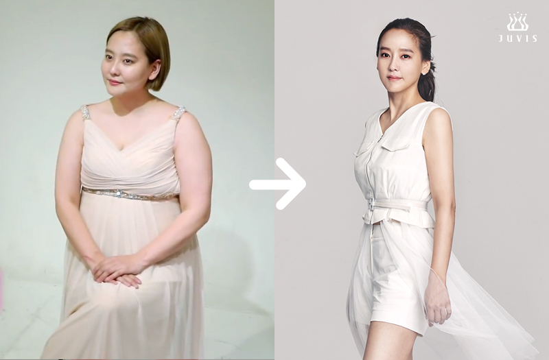 27kg 감량→우울증 극복→활동재개 준비…다나 "새로운 삶의 시작"[종합]