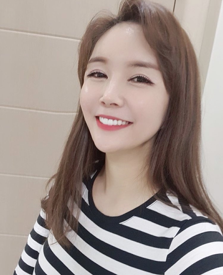 장영란, 성형설에 보정 애플리케이션 사용중단→"앱 못 끊겠다"