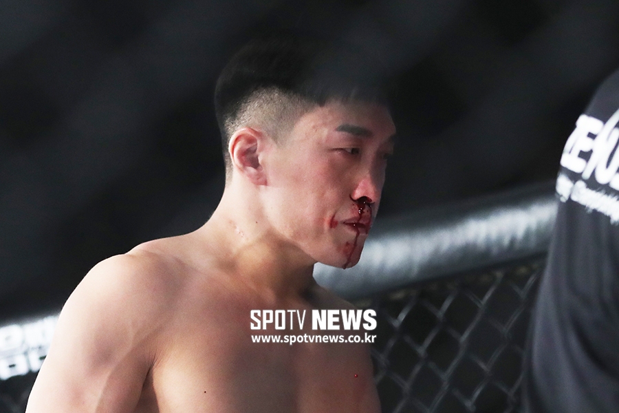 [포토S] 김민석, 과도한 출혈로 경기 중단
