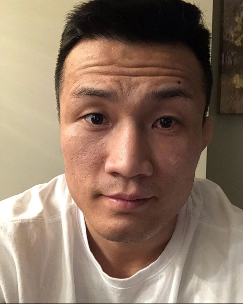 [정오의 UFC] 눈 수술 마친 정찬성 "이제 챔피언 될게요"