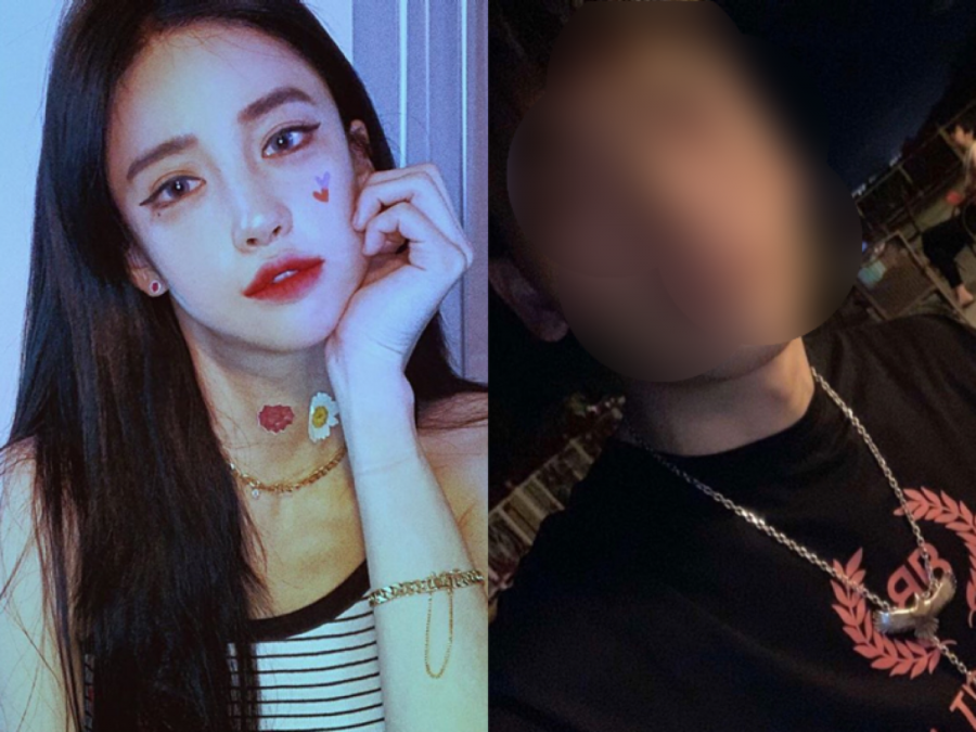 "중국인 소속사 사장에 폭행당했다"…반서진, 피해 사진 공개[전문]