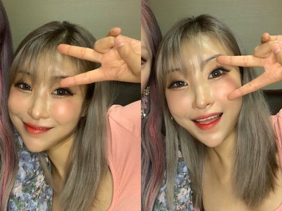 '43kg 인증' 이세영, 보톡스·필러시술 효과 톡톡…뾰족한 턱선 '리즈 갱신'