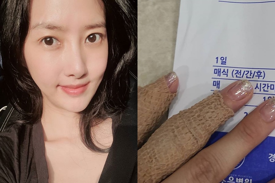 이선정, 개에 물려 응급실行→손가락 부상에도 "별일 아냐"[종합]