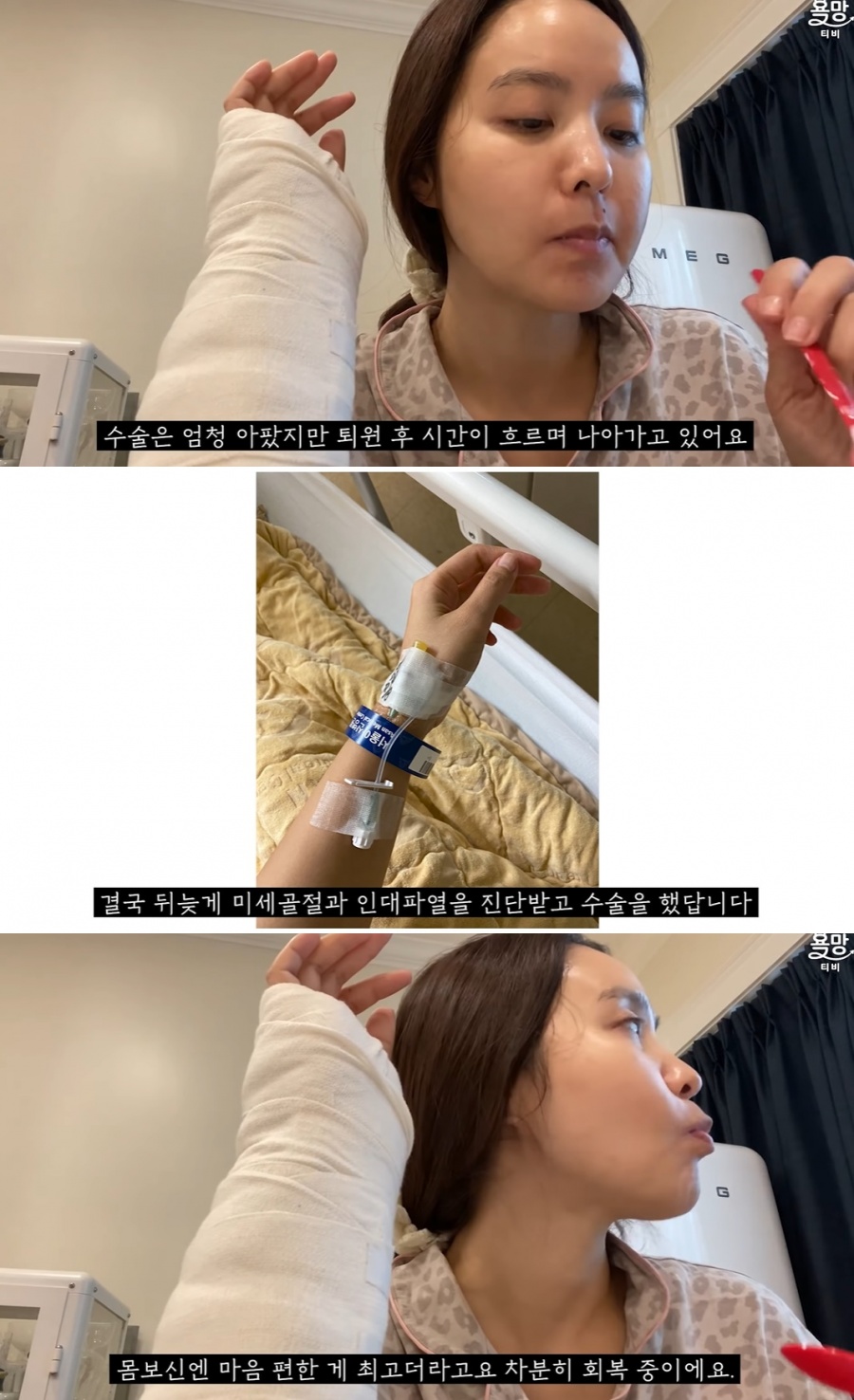 박지윤, 아찔했던 역주행 사고후 첫 근황…"미세골절-인대파열로 수술"