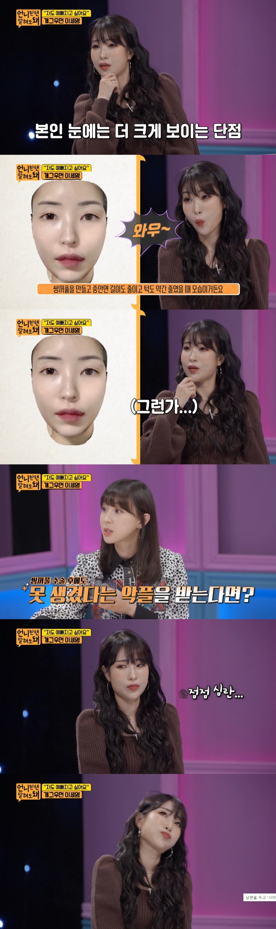'언니한텐' 이세영, 허리 20인치에도 '얼평' 악플→'쌍수' 예약 "견디기 힘들어"[TV핫샷]