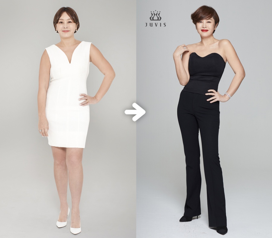 "두달 만에 -9kg" 갑상선기능저하증 이승연, 반쪽되니 더 어려져