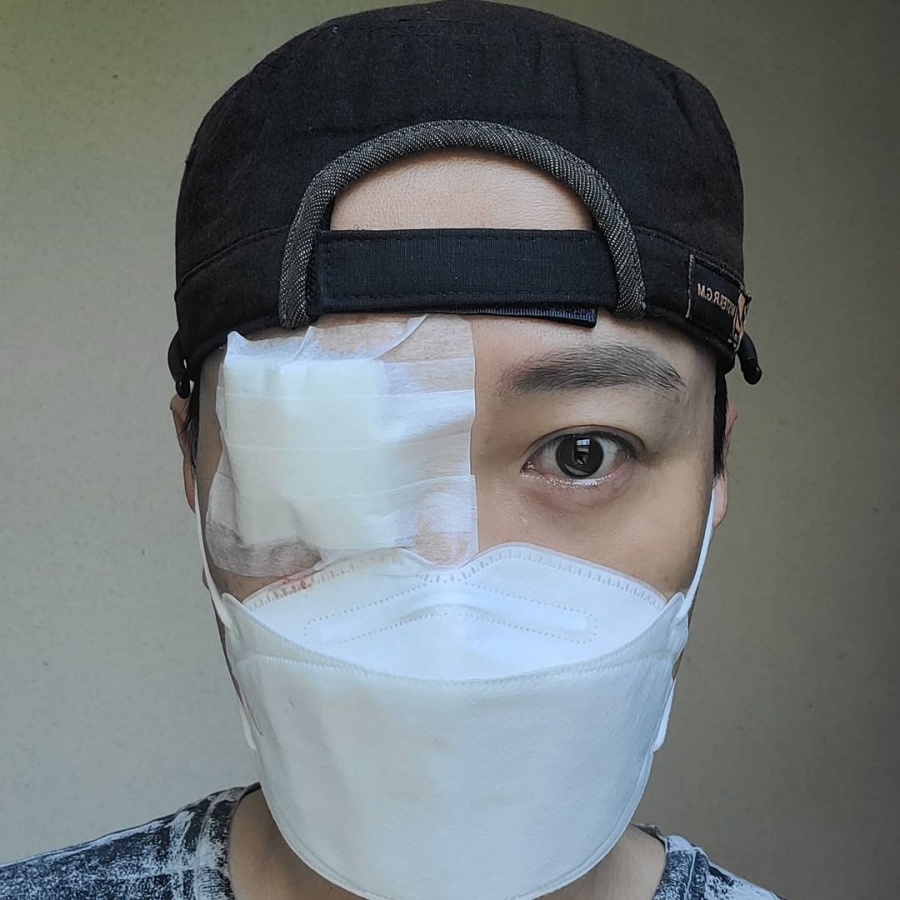 "4번째 눈 수술, 박살났어요" 문천식, 얼굴에 대형 반창고…무슨 일인가