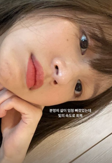 하니, 코로나19 완치 후 밝은 근황…"살 엄청 빠졌는데 빛의 속도로 회복"