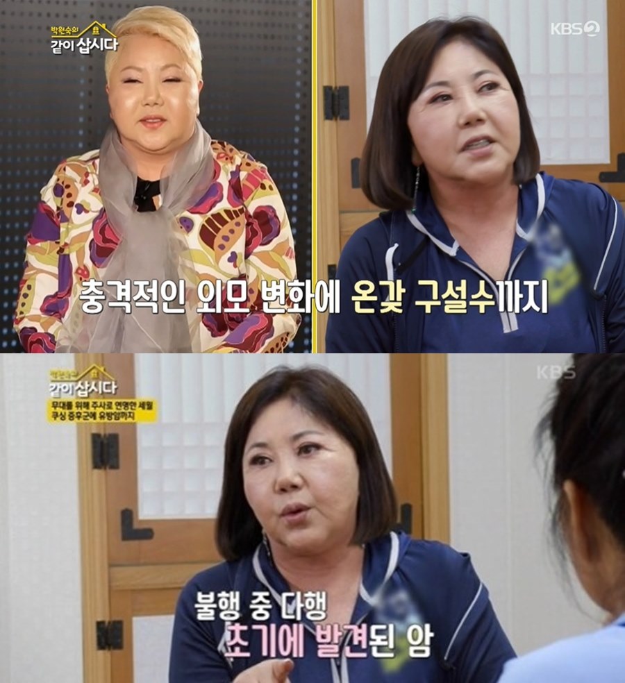 "풍선아줌마 같았다"…이은하, 쿠싱증후군·유방암 투병→개인파산 고백('같이삽시다')[TV핫샷]