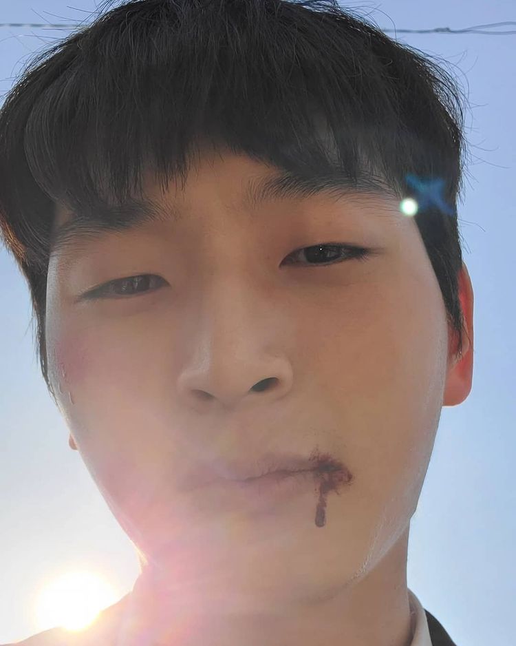 정진운, 조재윤에게 맞았나…피투성이 얼굴에 어두운 표정