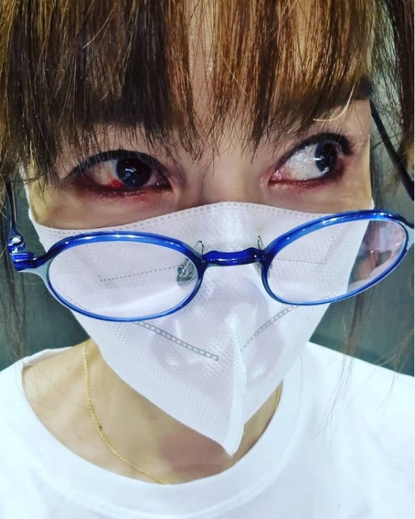 김혜리, 무슨 일이기에 눈 실핏줄까지 터졌나… "믿으면 도끼로 찍고"