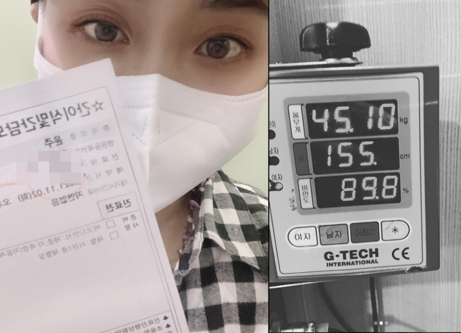 윤주, 간이식 후 9cm 줄었다…"164→155cm, 흉추압박골절 무서워"