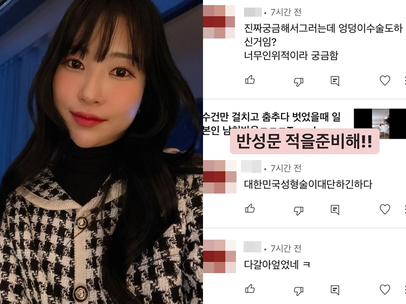 ▲ 출처| 이세영 인스타그램
