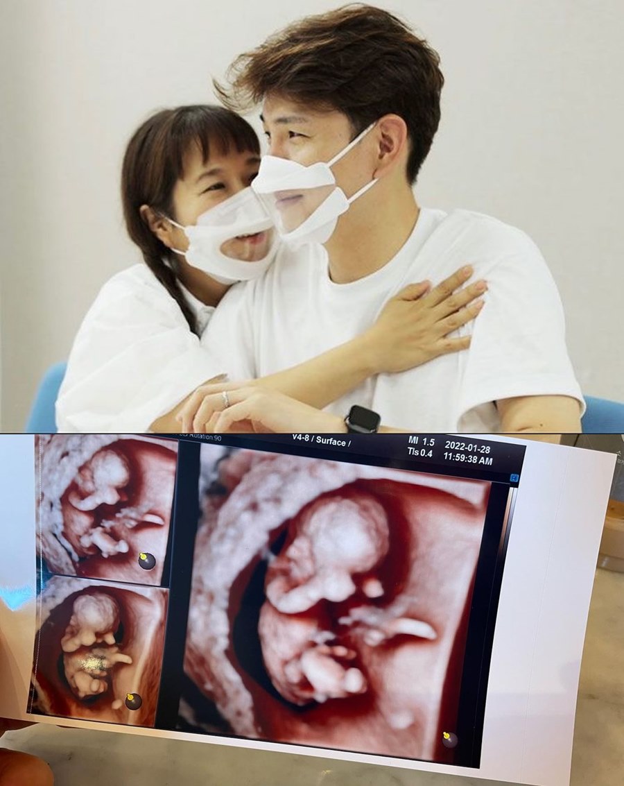 ▲ 홍현희 제이쓴 부부. 출처ㅣ제이쓴 인스타그램