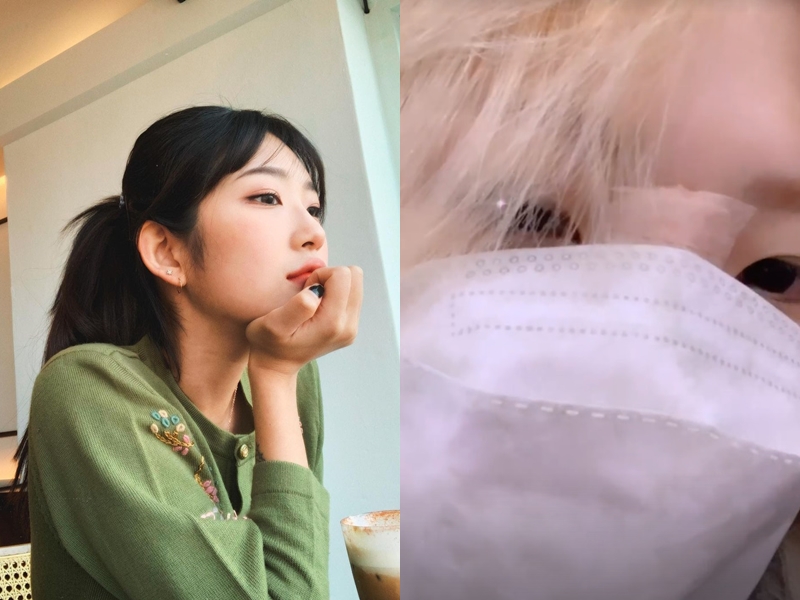 '故 최진실 딸' 최준희, 코 수술했나…미간 드레싱 테이프 포착