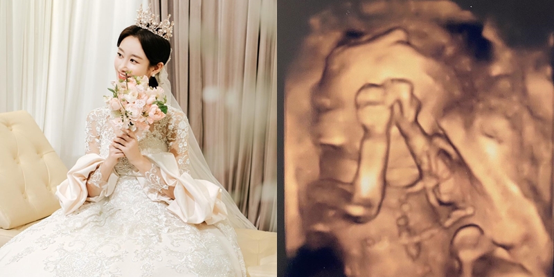 ▲ 출처| 송보람(금미) 인스타그램