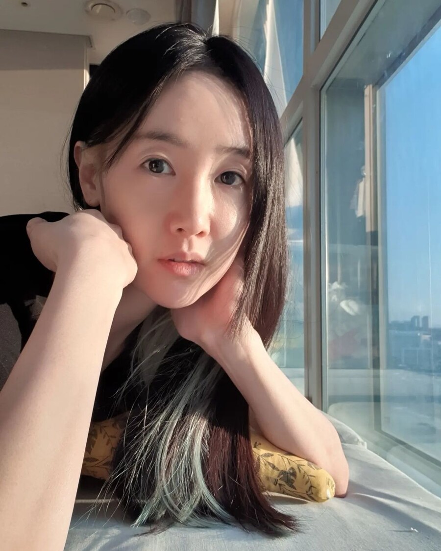 ▲ 출처| 별 인스타그램
