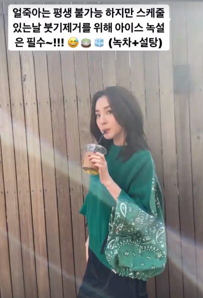 산다라박, 41kg인데 붓는게 가능하냐고…"부기 제거 위해 아이스 녹설"