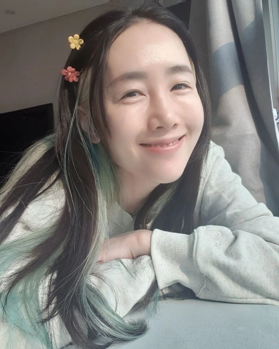 ▲ 출처| 별 인스타그램