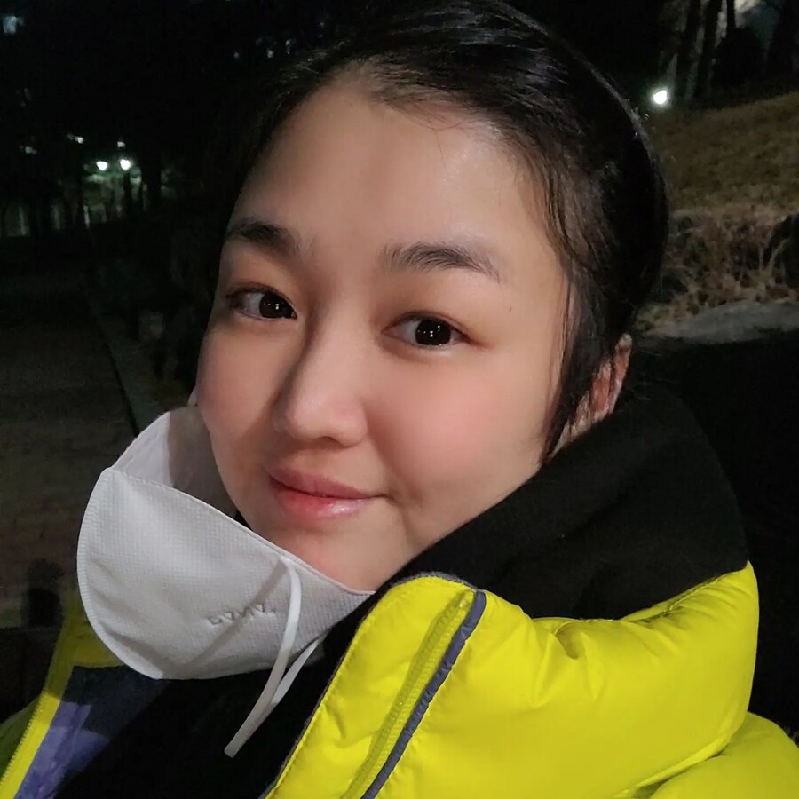 '송혜교 닮은꼴' 정미애, 갑작스런 활동 중단 "지난해  큰 수술 받아"