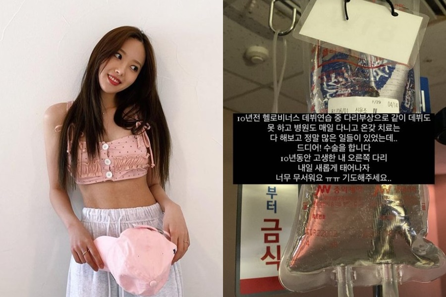 ▲ 헬로비너스 출신 윤조. 출처| 윤조 인스타그램