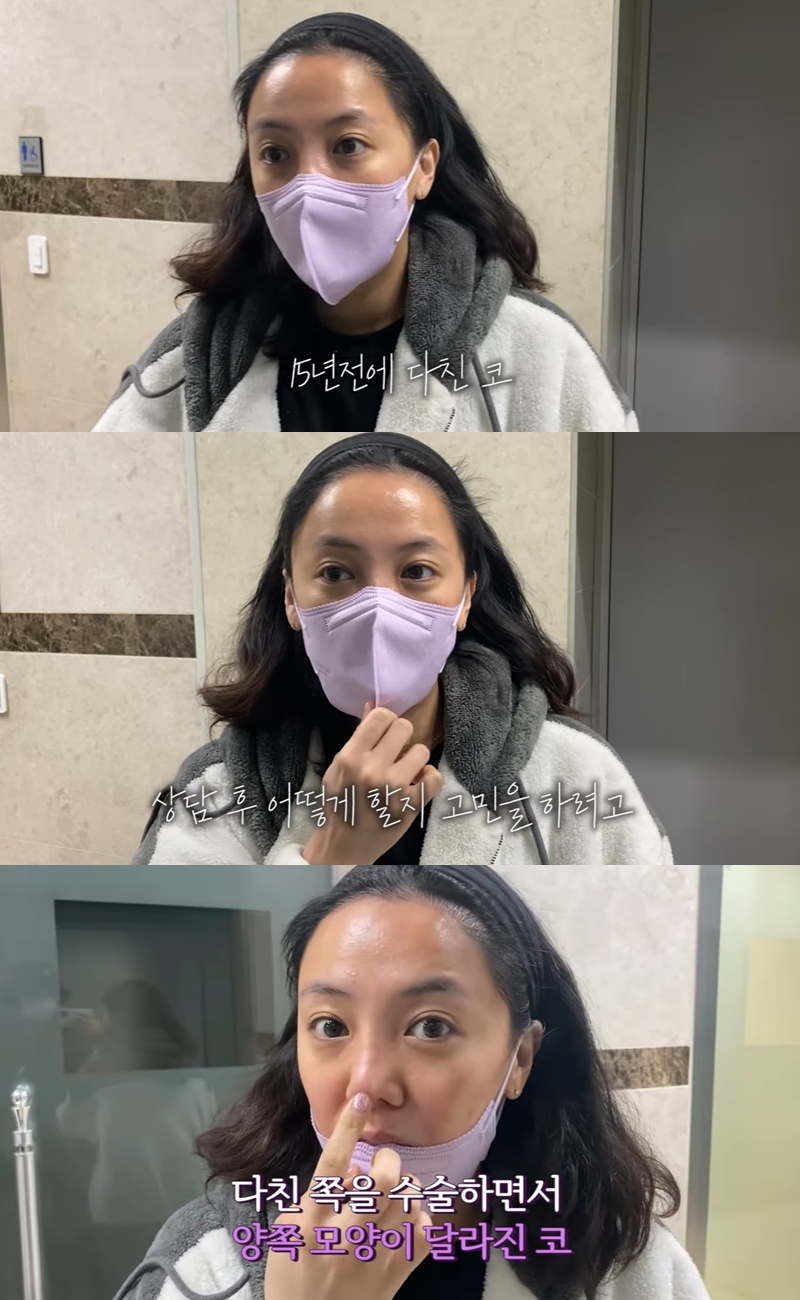 고은아, 15년 전 다친 코 상태 심각해…"복원 수술 고민"