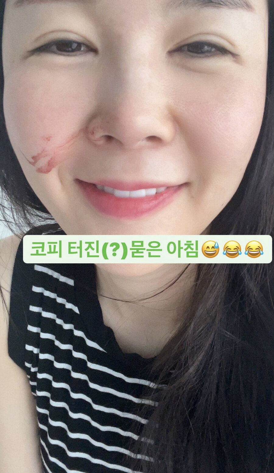 장영란, 결국 터질게 터졌다…방송·육아에 병원일까지 '무리였나'
