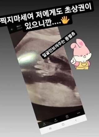 ▲ 출처| 홍현희 인스타그램