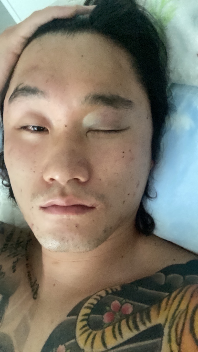 ▲ 설영호과 안과 골절로 다음달 출전이 불가능하다.