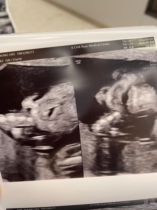 ▲ 출처| 김영희 인스타그램