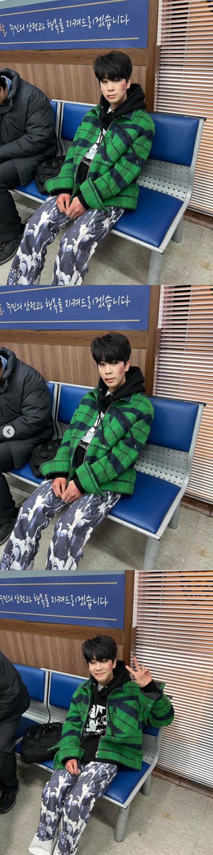 정동원, 무슨 일 겪었길래 얼굴이 피투성이네…팬들 가슴 무너지겠어