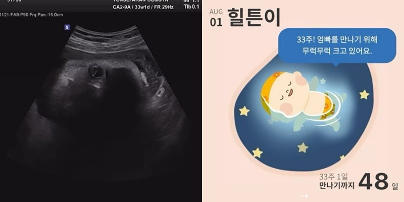 ▲ 출처| 김영희 인스타그램