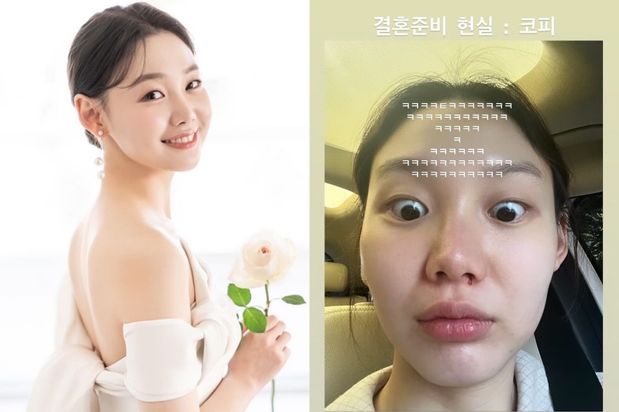 ▲ 출처|김수민 인스타그램