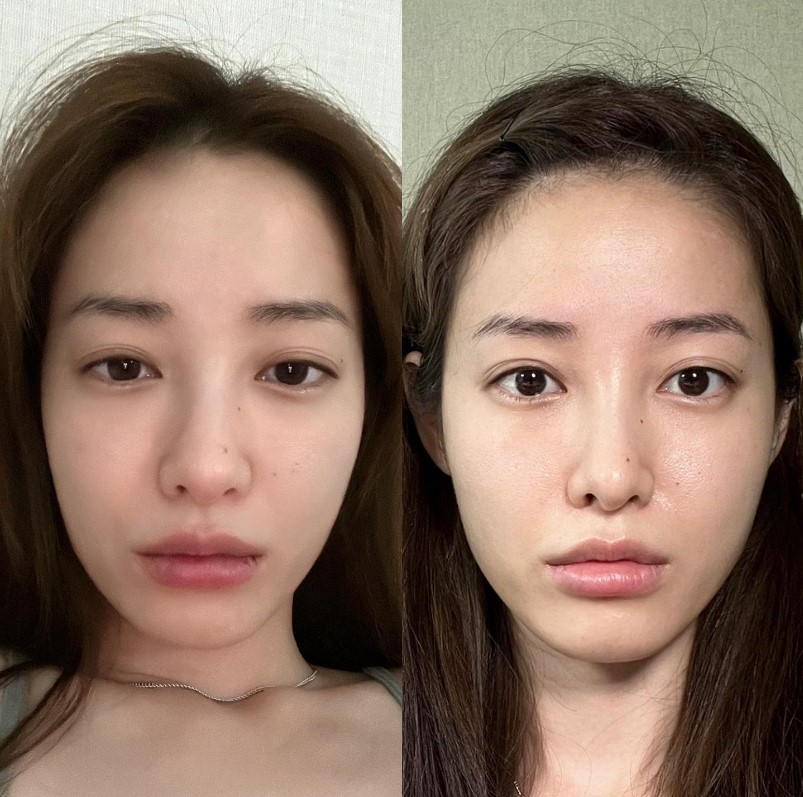 ▲ 뷰티 유튜버 유깻잎. 출처| 유깻잎 인스타그램