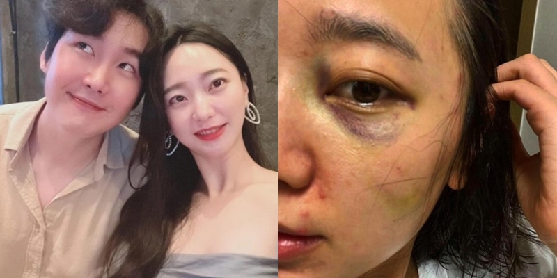▲ 출처| 서사랑 인스타그램