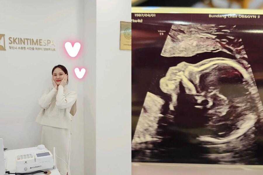 써니힐 빛나, 결혼 1년만 임신 “건강하게 잘 키우겠다”