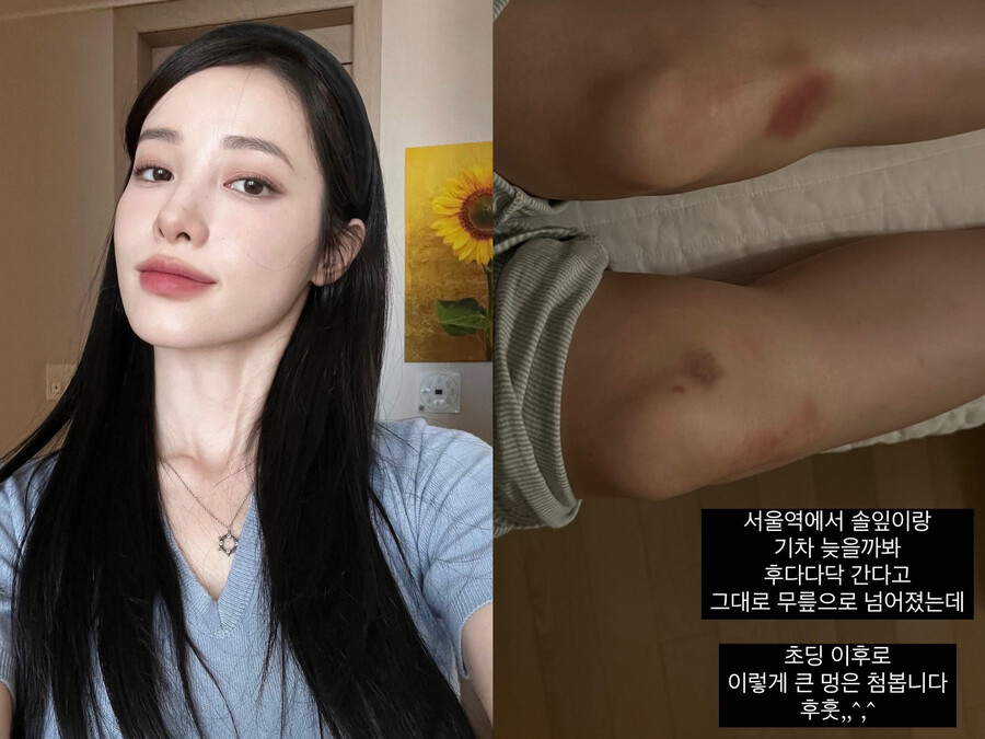 ▲ 출처| 유깻잎 인스타그램