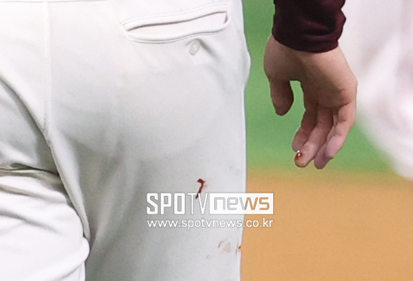 ▲ 한국시리즈 1차전 당시 물집 부상으로 오른손 중지에 출혈이 생긴 안우진.  ⓒ곽혜미 기자