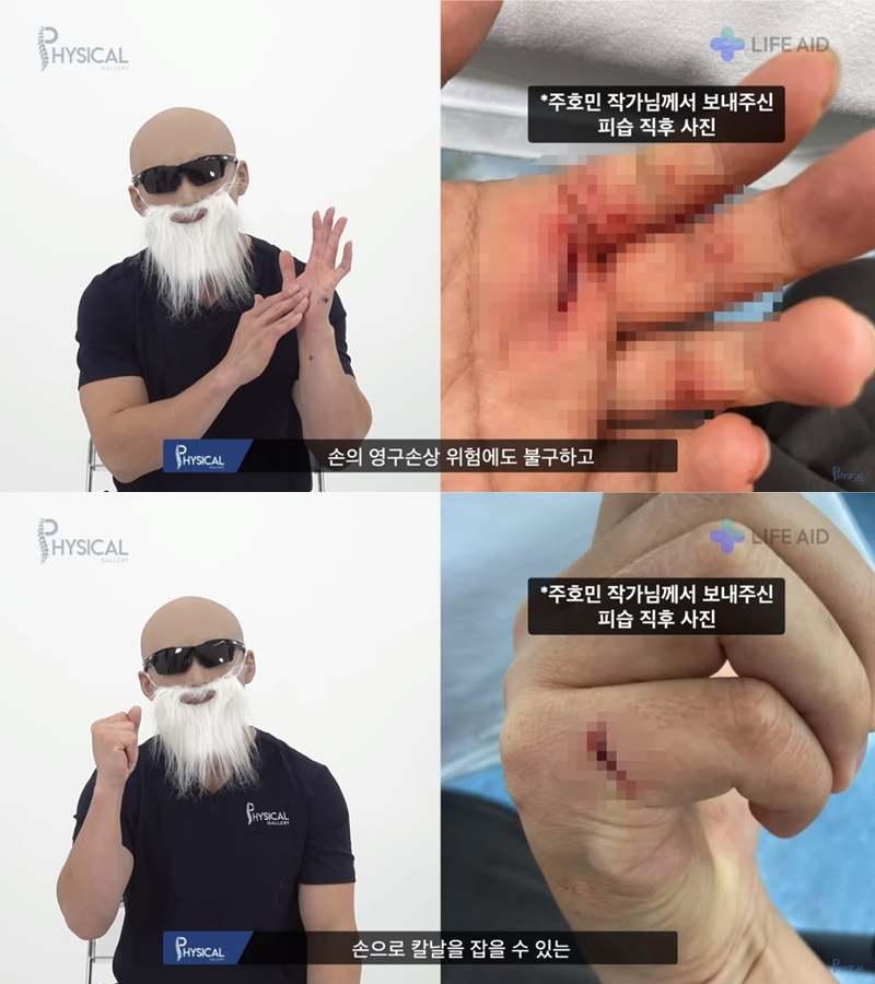 주호민 강도 피습 직후 이랬다…"손 영구 손상 위험에도 용기 있게 막아"