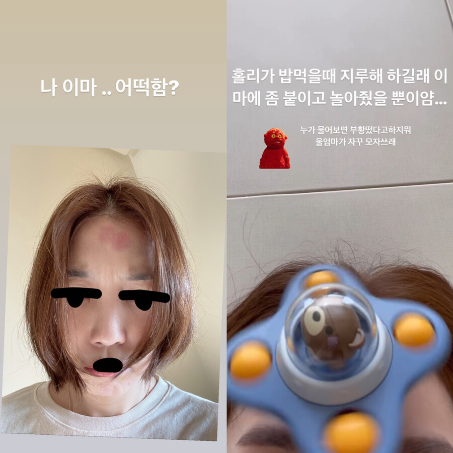 '임성빈♥' 신다은, 여배우 이마에 저걸 어쩌나…'열혈육아'의 결과