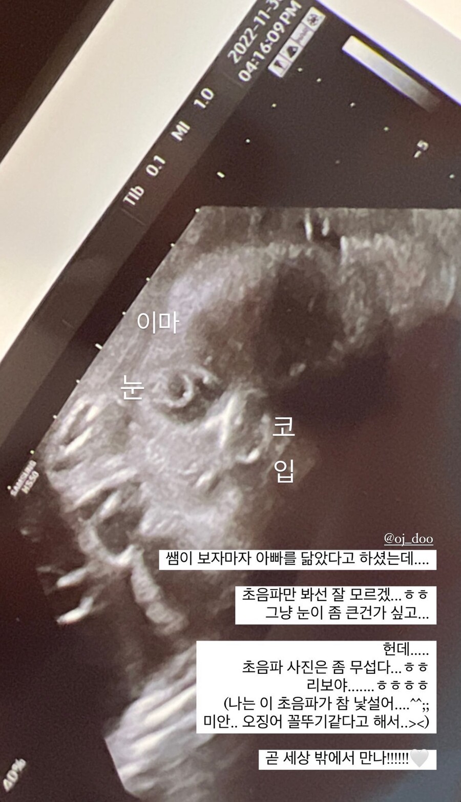 ▲ 출처| 영숙 인스타그램