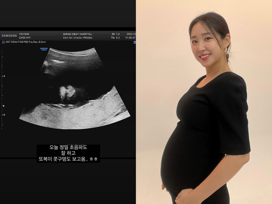 ▲ 출처| 최희 인스타그램