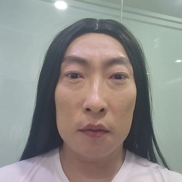 박명수, 탈모 치료받고 풍성해진 머리카락…♥한수민 "놀랐잖아"