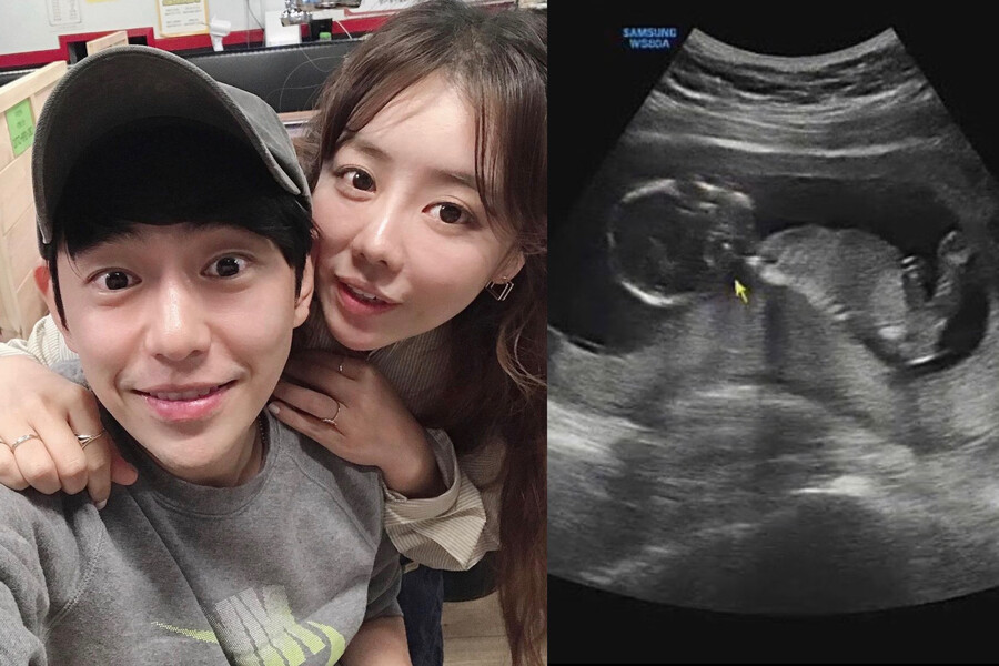 ▲ 출처| 베니 인스타그램