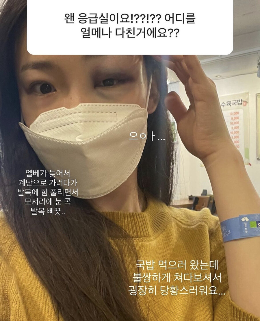 '돌싱글즈' 맥심 모델 이아영, 피멍 든 눈 '충격 비주얼'