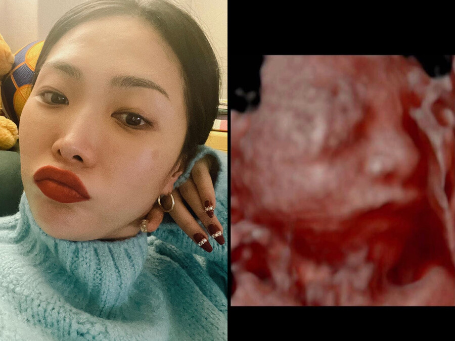 ▲ 출처| 허니제이 인스타그램
