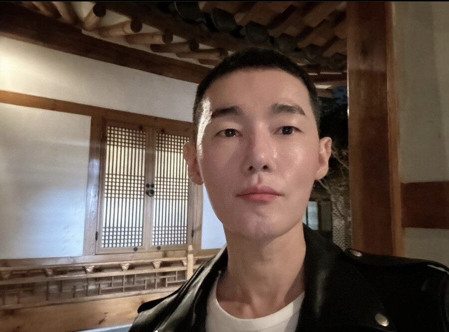 허지웅, 돈주고 못 한다는 정초 액땜 "욕실서 미끄러져 안와골절"